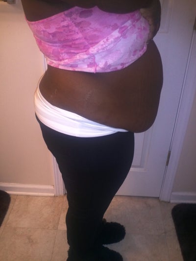 tummy tuck cost georgia tummy tuck cost georgia