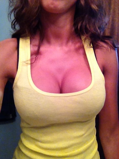 Breast Augmentation In Edmonton Ab 51