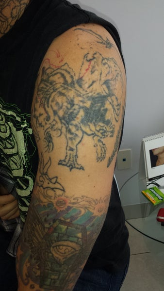 tattoo removal beverly hills ca picosure review tattoo removal beverly hills ca picosure review