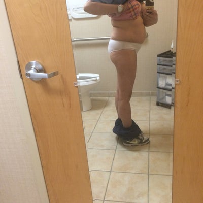 Soon To Be DuranDoll June 30 2015! Lipo, TT & BBL ...