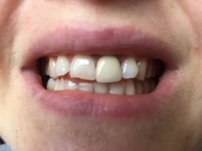 nothing but blackened teeth reviews nothing but blackened teeth reviews