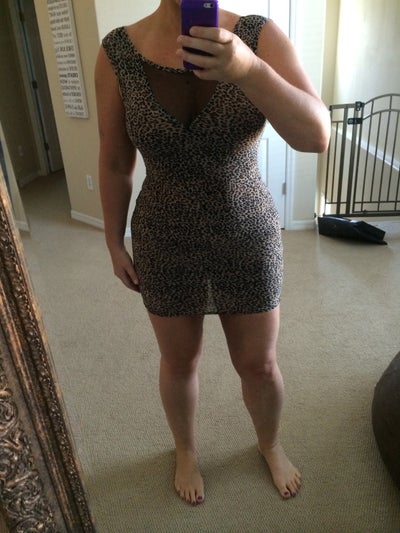 BBL with Dr. Ortega! Miami, FL - Brazilian Butt Lift review - RealSelf