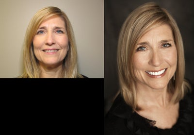 Zoom Whitening; Porcelain Veneers; Porcelain Crowns -
Zoom Teeth Whitening;Porcelain Veneers and Porcelain Crowns restored this patient's confident smile.