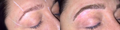 Woman treated with Microblading - Woman treated with Microblading