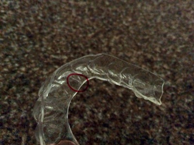 retainer plastic upper clear cracks affect effectiveness within does crack ago