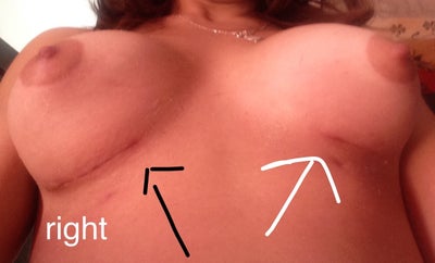 girl teen hard breast video implant moves