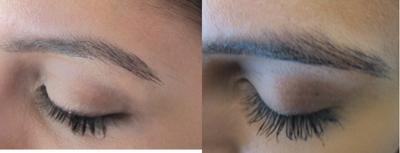 Latisse - Eyelash Growth - Eyelash growth after 16 weeks.