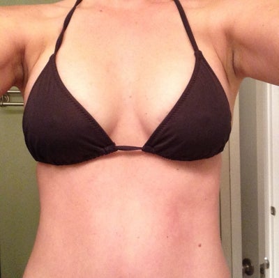 naked ladies esctasy 225cc breast implants