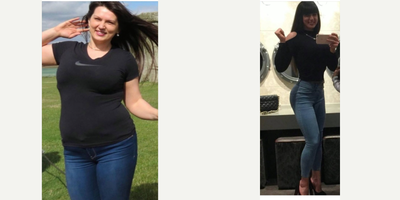 18-24 year old woman treated with Gastric Bypass - Being happy achieving her dream
