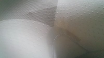 Mons+Veneris+Videos How long will my mons pubis area hurt after lipo? (Photo) Doctor ...