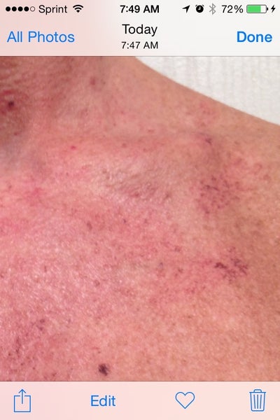 BBL Without Brown Filter (For Now) - Miami, FL ...