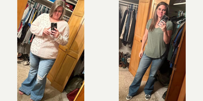 25-34 year old woman treated with Gastric Bypass - The patient underwent gastric bypass surgery on March 18, 2024, starting at 111 kg (245 lbs). Six months later, as of September 11, 2024, she has lost an impressive 47 kg (104 lbs), now weighing 64 kg (141 lbs). The patient reflects on her journey, saying, Some say that weight loss surgery is the easy way, but little do they know that it is not just a physical change in life, but it is also a mental change! WLS gives you a tool to do what's right, to do better, live better, and be healthier. She also adds, Im so very thankful for this choice, this doctor and his team, and all the support from my loved ones at home.