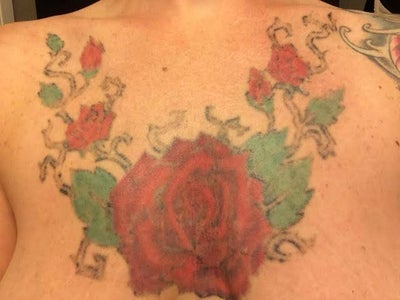 ... Chest Piece Tattoo - Austin, TX - Tattoo Removal review - RealSelf