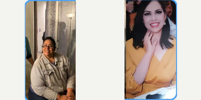 54 year old woman treated with Gastric Bypass - she lost 85 pounds in 8 months