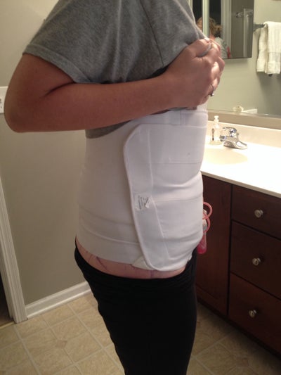 tummy tuck recovery week 4 tummy tuck recovery week 4