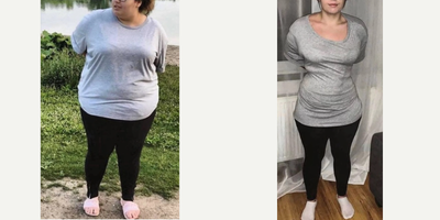 25-34 year old woman treated with Gastric Bypass - New you is her title now