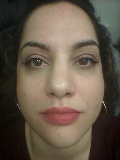 nose nostrils wide flared huge rhinoplasty base realself