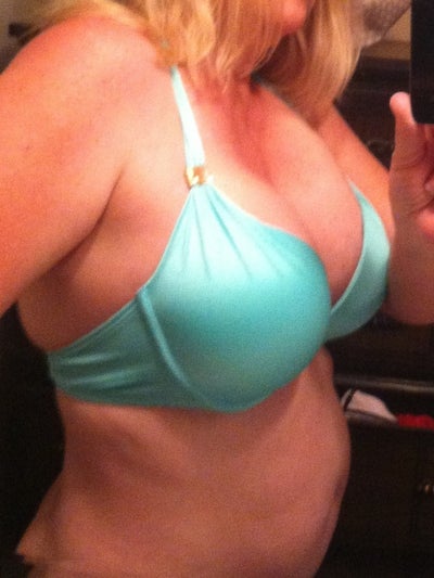 Breast augmentation cost dallas tx