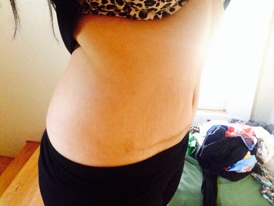 tummy tuck price
