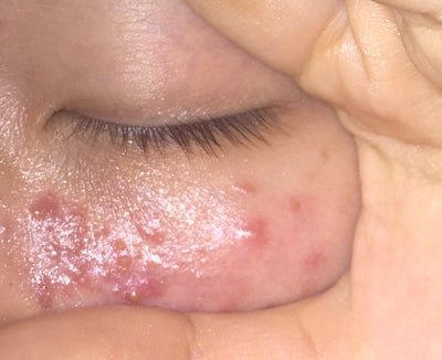 What are these and how to get rid of it? (photos) Doctor What are these and how to get rid of it? (photos) Doctor