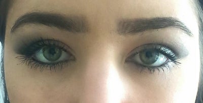 one pupil bigger than the other