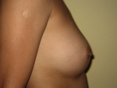exercise for facial muscles sports hot slip nude videos