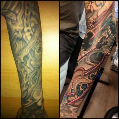 Tattoo Removal of a Full Sleeve and a Lowerleg Sleeve ...