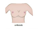 glossary to breast augmentation and implant terms