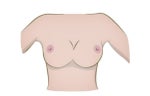 Uniboob