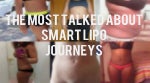The Most Popular Smart Lipo Transformations - 10 Before and Afters
