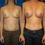Photo credit: Dr. Tom Pousti