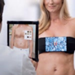 Visualize Your Breast Augmentation With Illusio 3D Simulation