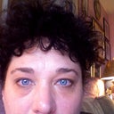 Puffy and Drooping Eyelids After Botox Doctor Answers, Tips