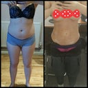 blured vaser_lipo_girl