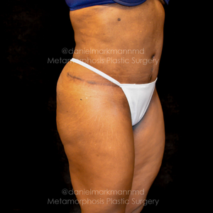 Daniel P Markmann Md Reviews Before And After Photos Answers Realself