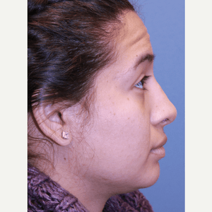 Bradford S Patt Md Reviews Before And After Photos Answers Realself Free parking, short lines and low fares. bradford s patt md reviews before