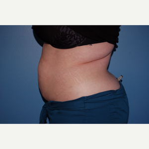 John W Zinsser Md Reviews Before And After Photos Answers Realself