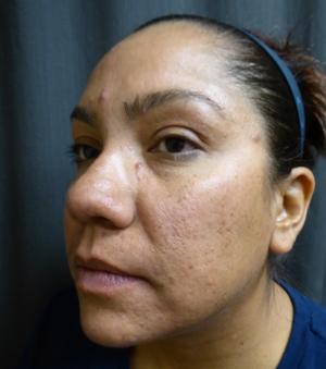 Warren Schutte Md Reviews Before And After Photos Answers