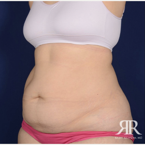 Rady Rahban Md Facs Reviews Before And After Photos Answers Realself