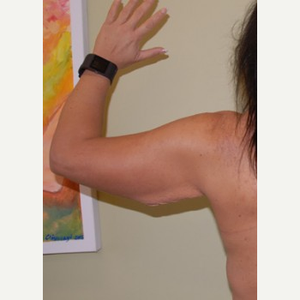 Umeng David Thao Md Reviews Before And After Photos Answers Realself