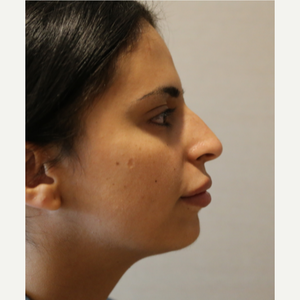 Yucel Sarialtin Md Account Suspended Reviews Before And After Photos Answers Realself