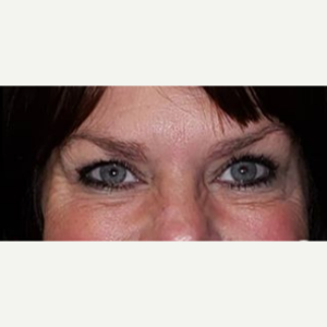 Medical Spa Np Lancaster Lancaster Ohio Realself