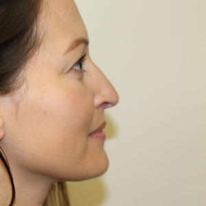 Pensacola Plastic Surgery Cost