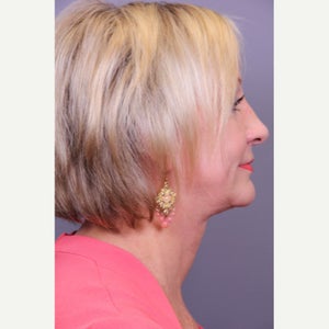 Sonny O Md Reviews Before And After Photos Answers Realself