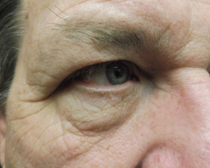 Warren Schutte Md Reviews Before And After Photos Answers
