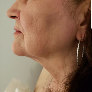 Barry Ginsburg Md Reviews Before And After Photos Answers Realself