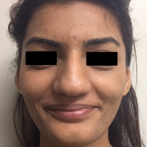 Richard Mark Winters Md Reviews Before And After Photos Answers