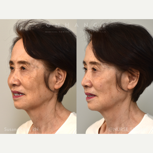 Charles S Lee Md Facs Reviews Before And After Photos Answers Realself