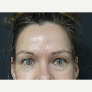 Ozge Ergun Md Reviews Before And After Photos Answers Realself