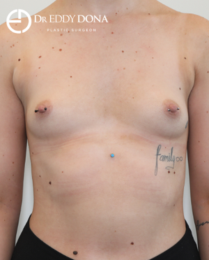 Eddy Dona Mbbs Fracs Reviews Before And After Photos Answers Realself